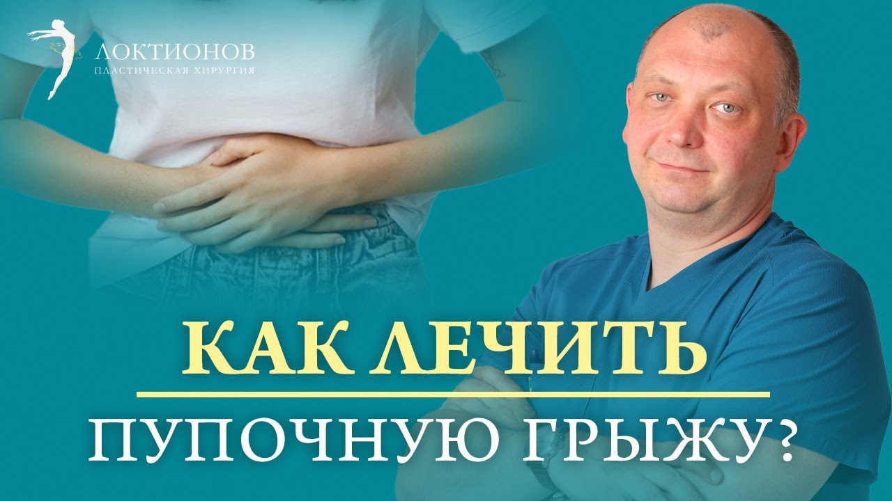 Пупочная грыжа у взрослых | Как образуется пупочная грыжа? | Современные методы лечения