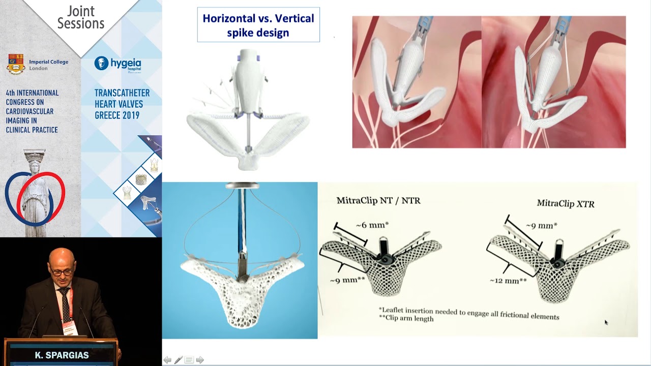 K. Spargias | Mitraclip vs. PASCAL. Similarities and differences