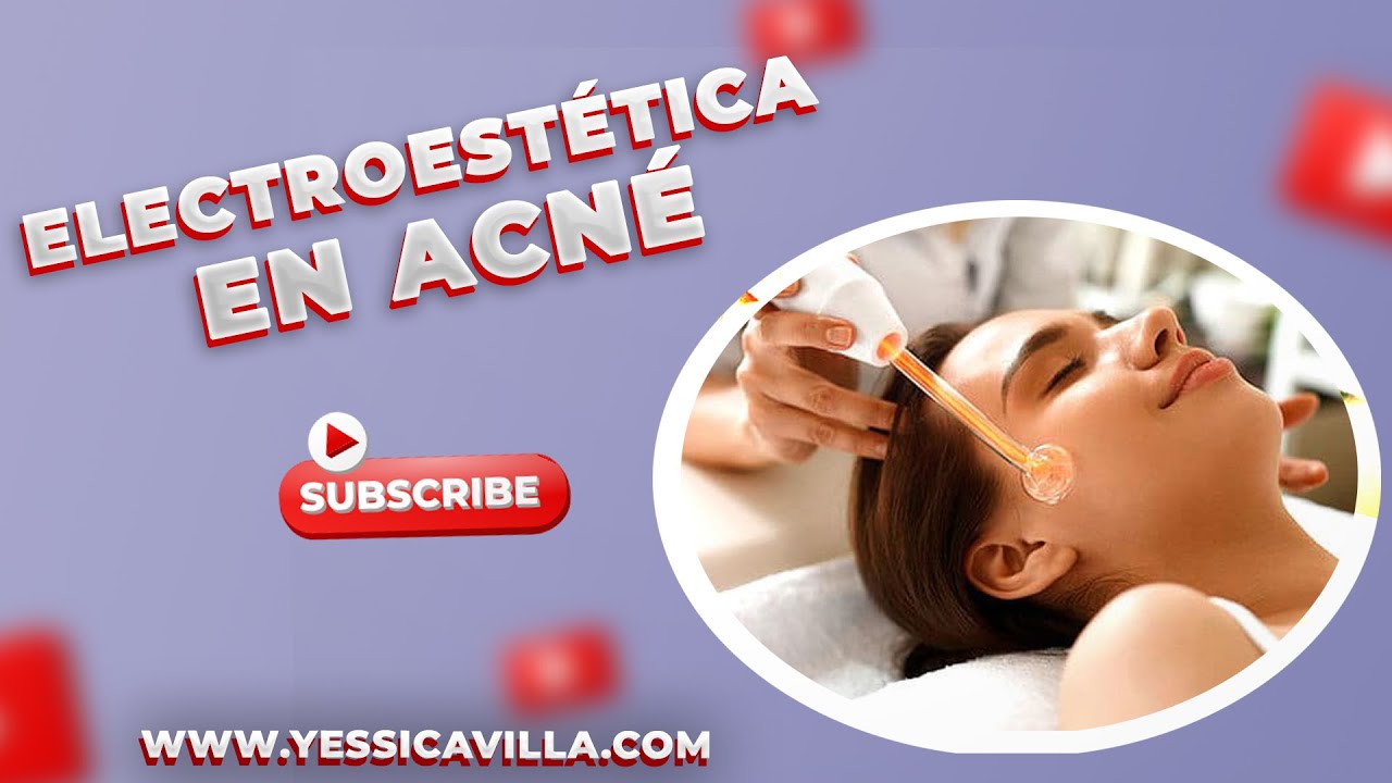ELECTROESTÉTICA EN ACNÉ