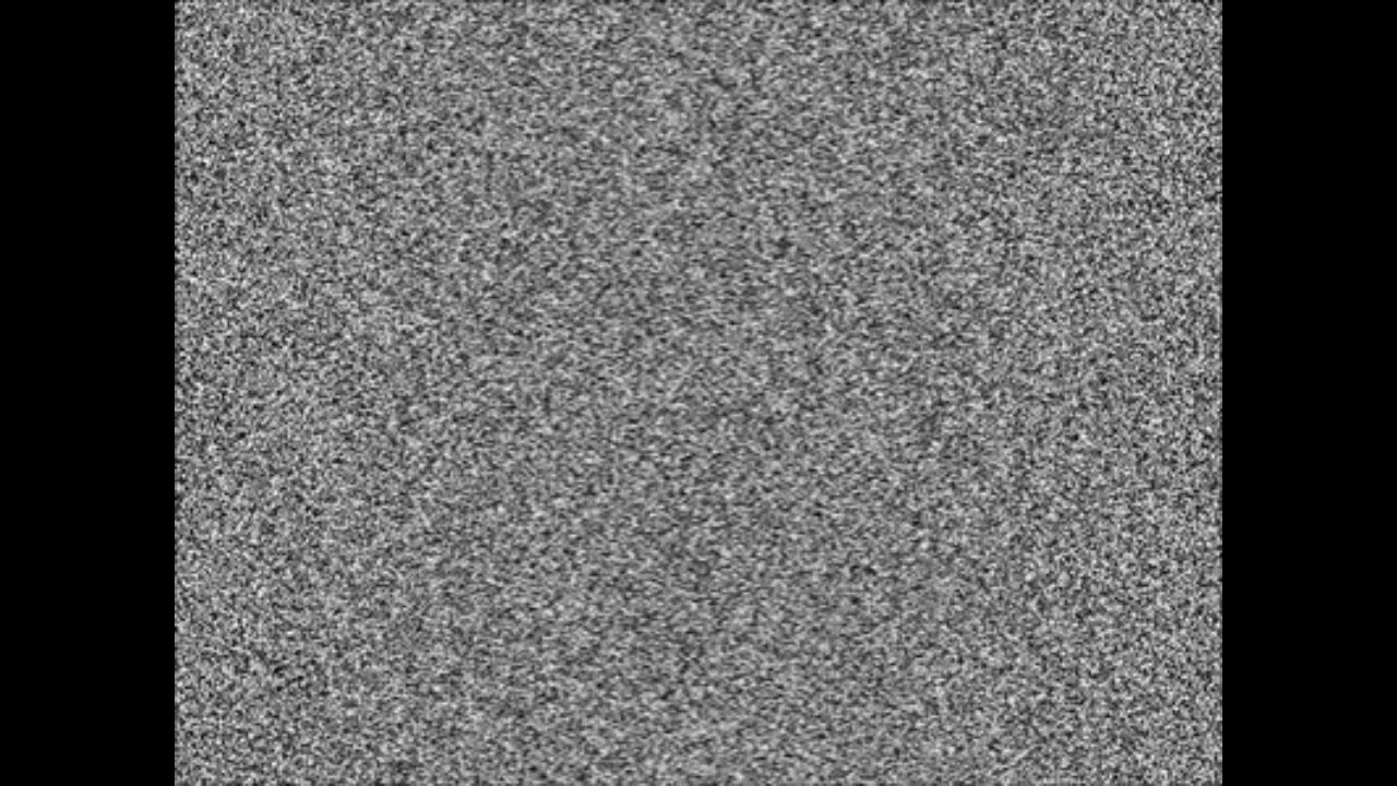 달팽이이비인후과 이명 소리치료6(백색소음)