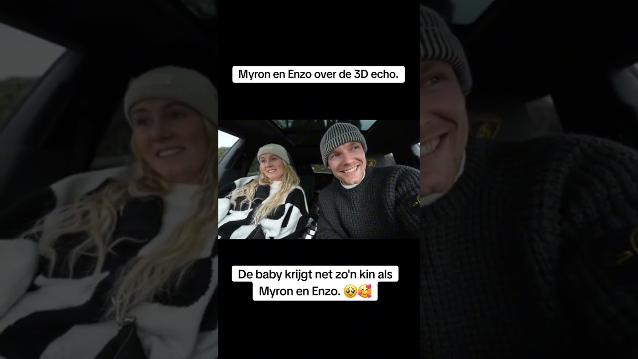 De Zoontje Van EnzoKnol Krijgt Een Kin Als Jade 😱😱 #shorts #enzoknol #fouryoupage #subscribe #gio