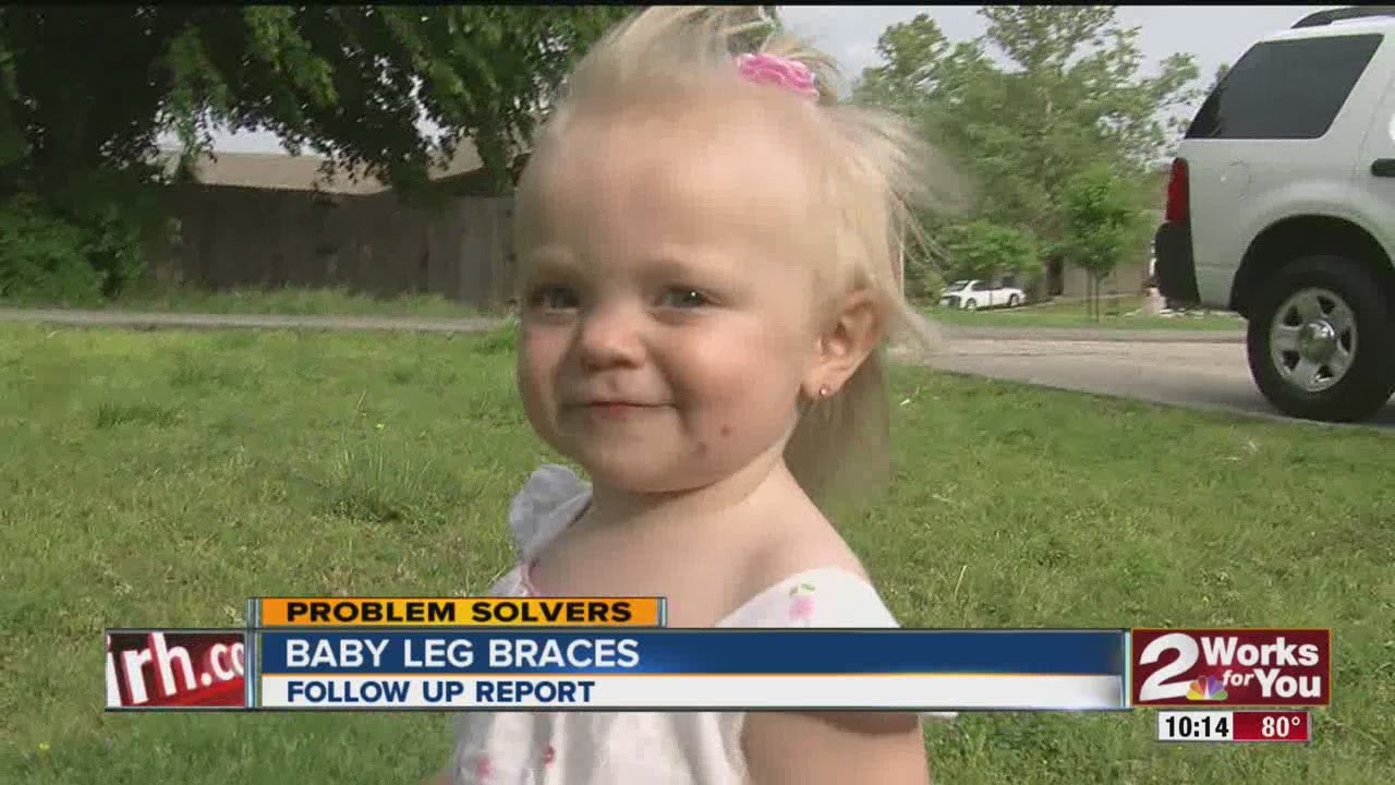 Baby Leg Braces - Follow Up Report