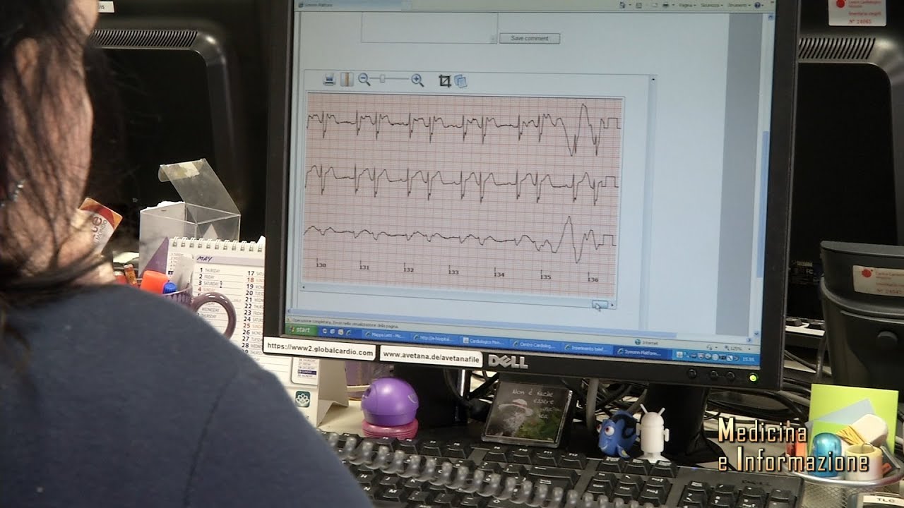 Fibrillazione atriale  e anticoagulanti orali per ridurre il rischio cardioembolico