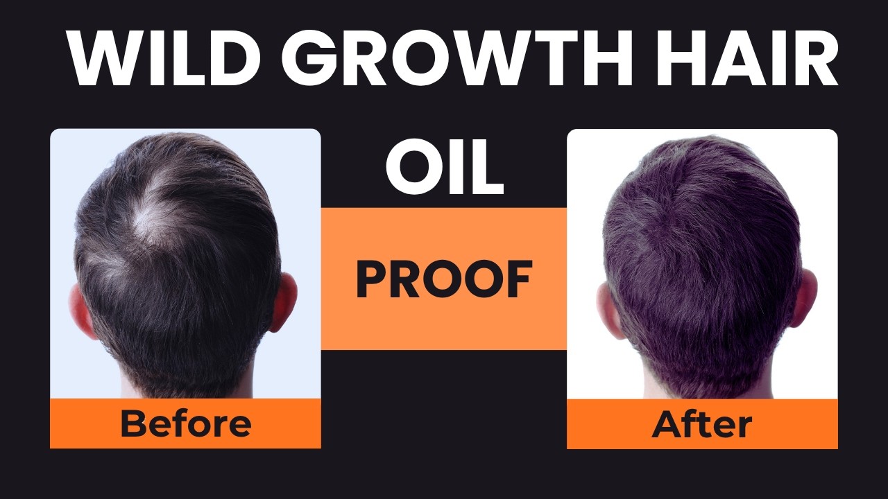 💥 Wild Growth Hair Oil Review: Does It Really Grow Hair &ndash; Fact or Fiction?