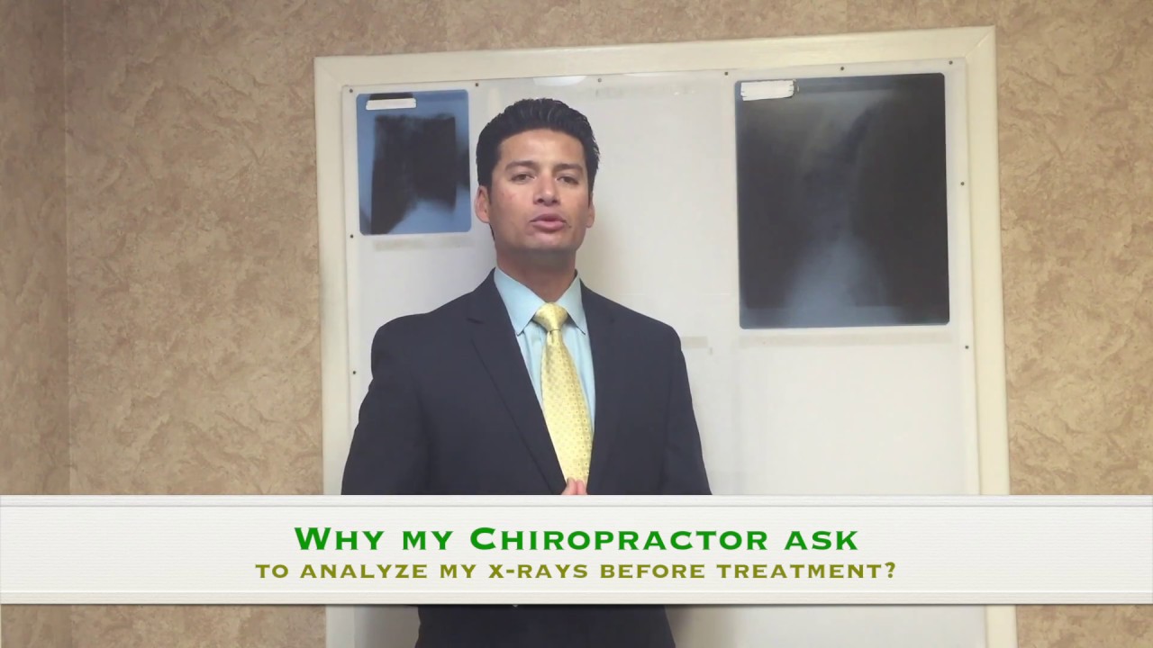 How to Find a Chiropractor by Their X-Ray Analysis