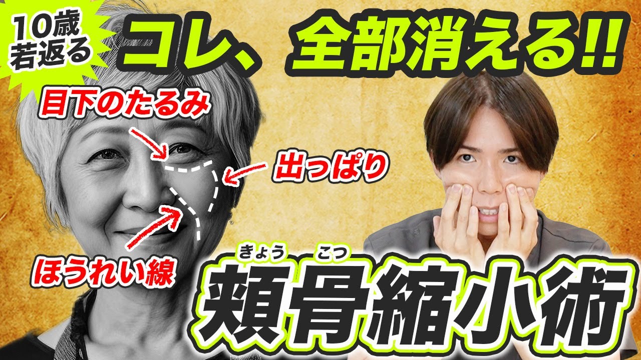 【頬骨縮小術】頬骨の出っぱりを消せば、ほうれい線も目の下のたるみも消える‼️