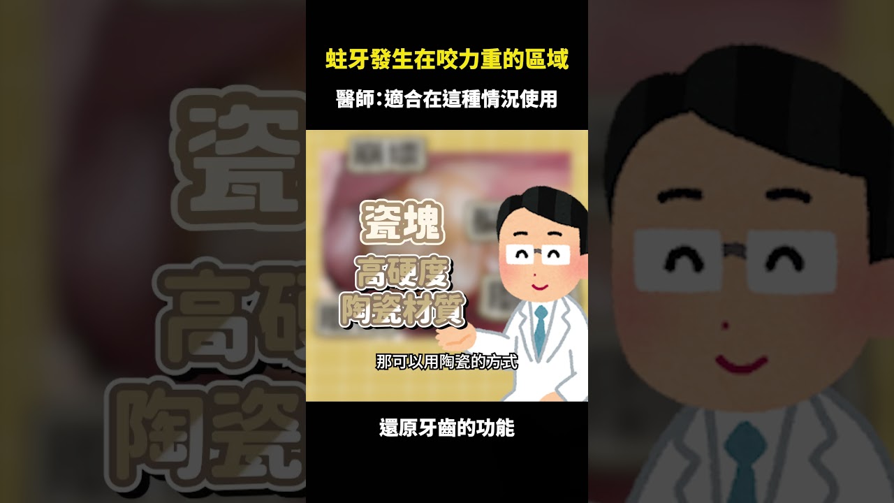 蛀牙發生在咬合力重的臼齒該怎麼辦？ ｜【祐民牙醫－隱適美旗艦店】許四融醫師 #蛀牙 #瓷塊 #補牙 #祐民牙醫