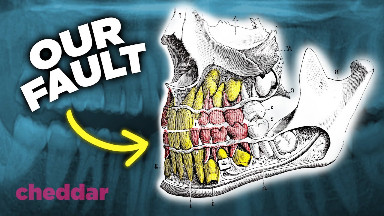 The Surprising Reason Why Human Teeth Are A Design Disaster - Cheddar Explains