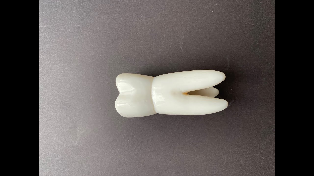 Sabundan Üst 1. Molar Diş Yapımı (Kök Bölümü) | Maxillary First Molar |