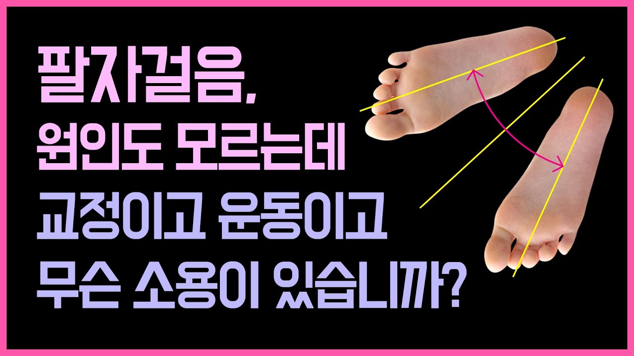 팔자걸음, 원인도 모르는데 교정이든 운동이든 무슨 소용이 있습니까?