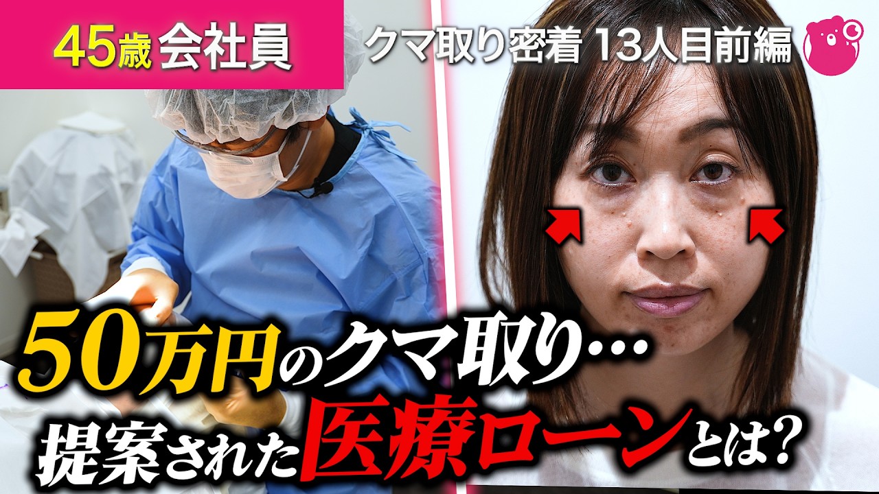 【目の下のたるみ取り】金額公開！45歳ママ「息子のためにも若くありたい」選んだクマ取りは…？【クマ取り密着13人目前編】#美容整形#湘南美容クリニック