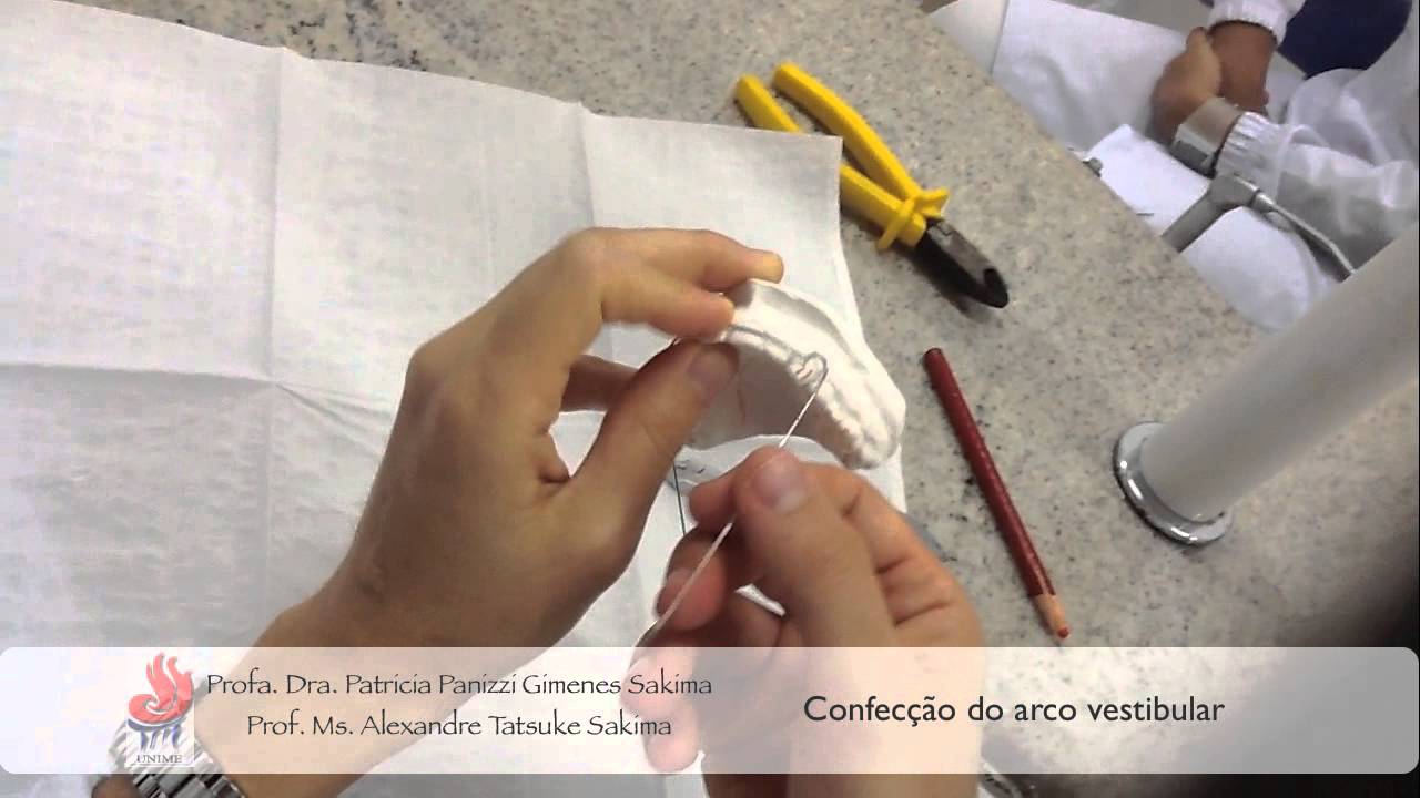 Arco vestibular de Hawley
