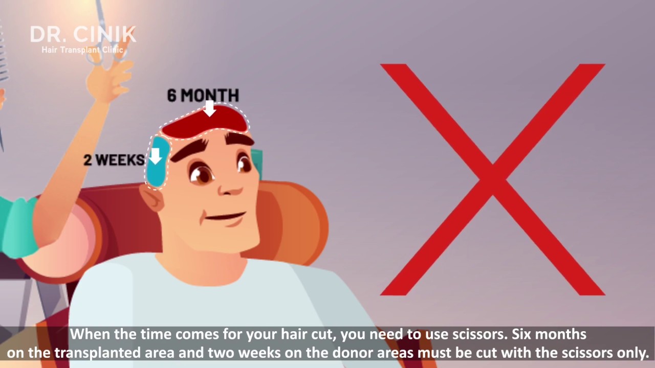 💇‍♂recuperación de un trasplante capilar: consejos y cuidados💆‍♂. Primer mes injerto de pelo