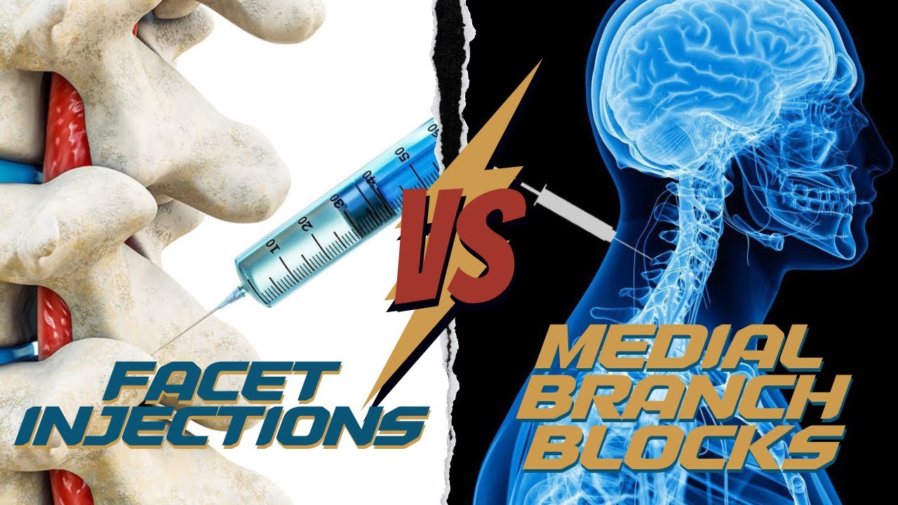 Facet Injection vs Medial Branch Blocks