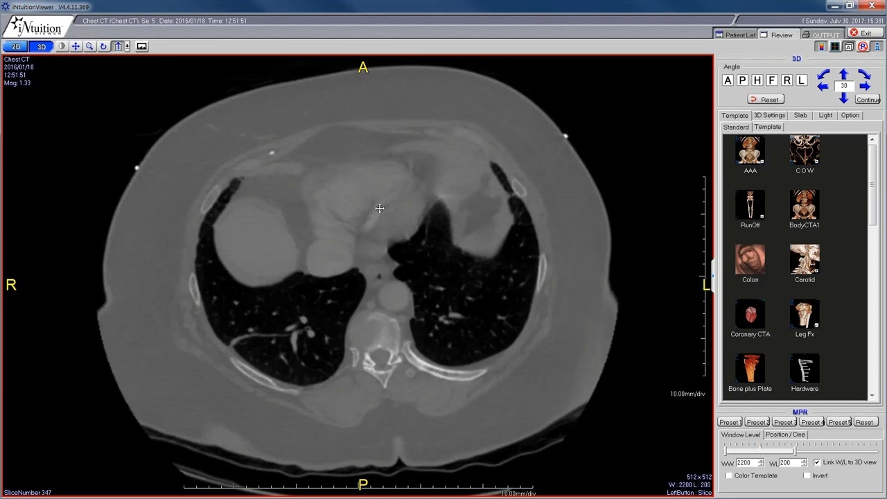 PC DICOM Viewer