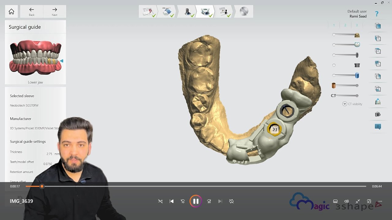 Step by step tutorial on 3Shape Implant Studio \ introduction & importing data