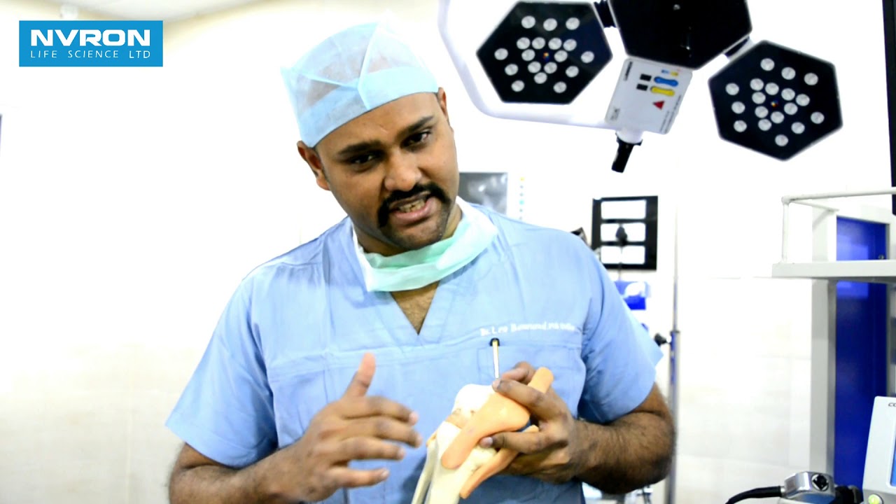 Knee Arthroscopy: Reasons & Procedure in Tamil I Patient Education I MIC
