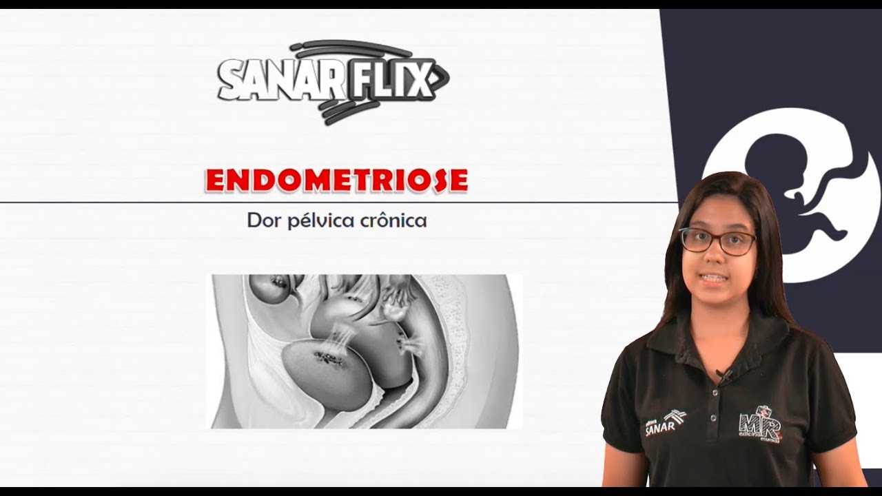 Endometriose - Módulo Ginecologia - Aula SanarFlix