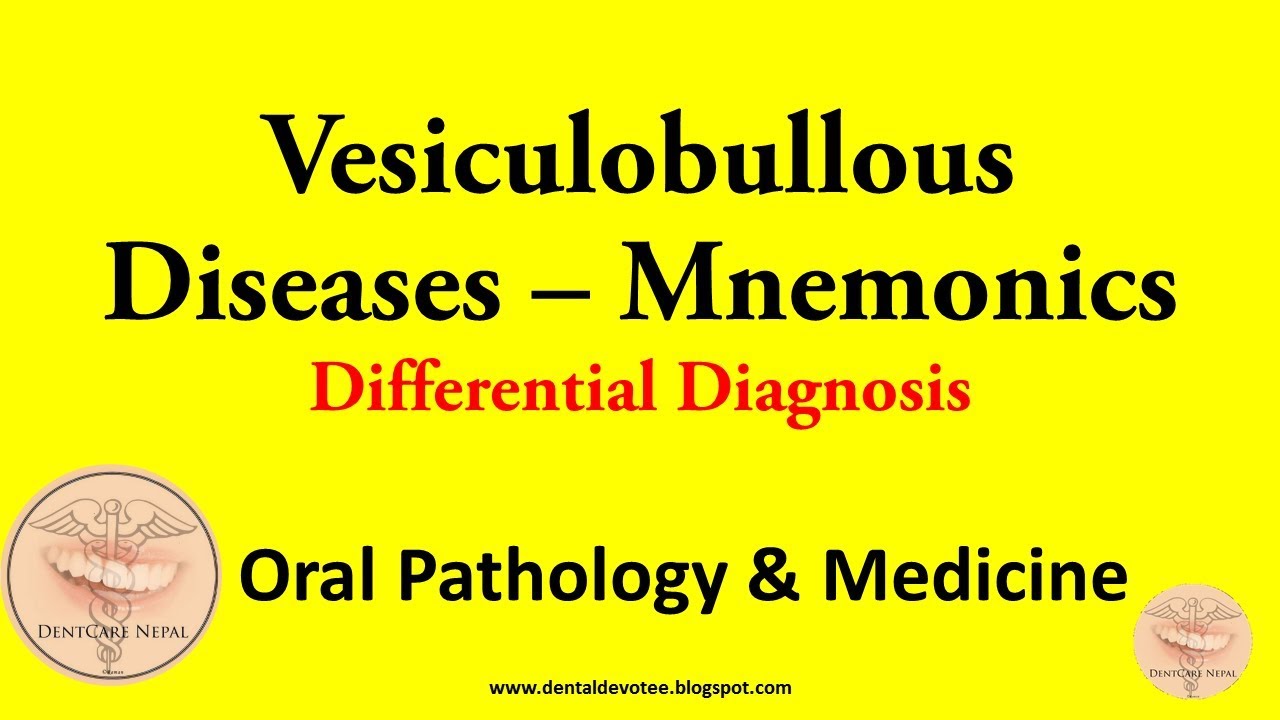 MNEMONICS - Vesiculobullous Diseases Differential Diagnosis - Oral Medicine and Pathology