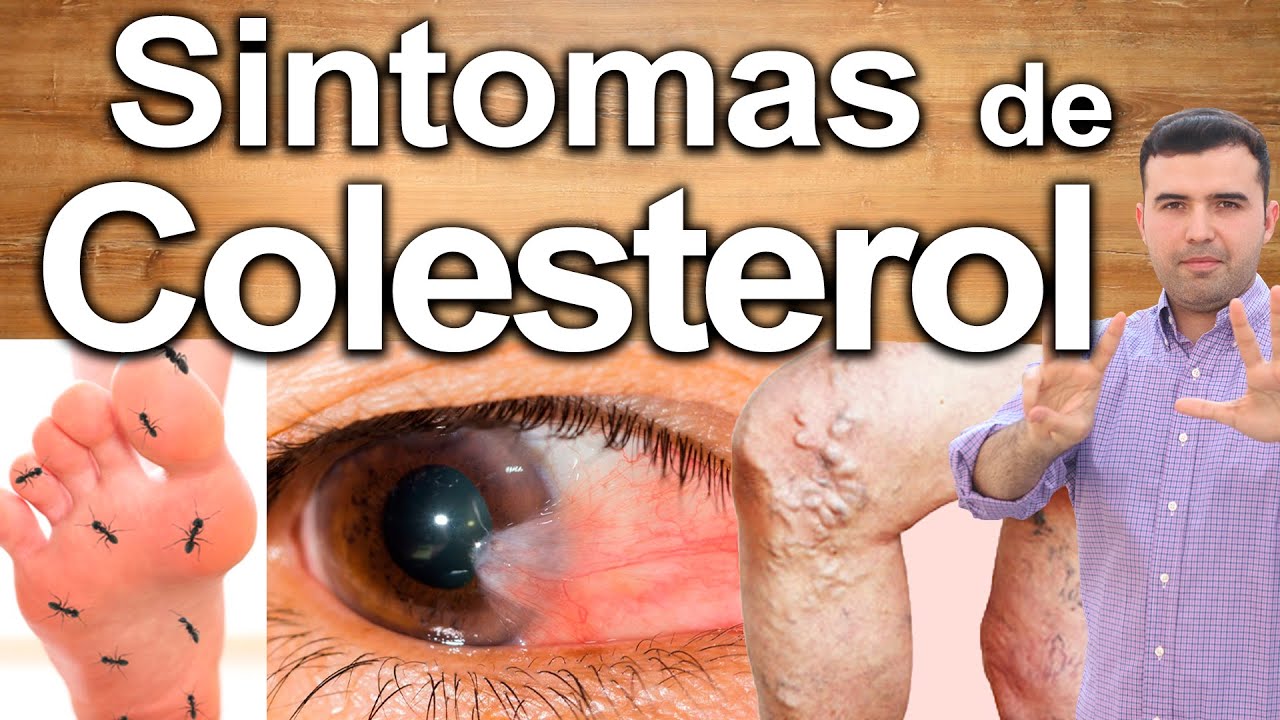 Cómo Saber Si Tu Colesterol Está Alto - No Ignores Los Signos Y Síntomas De Colesterol Elevado