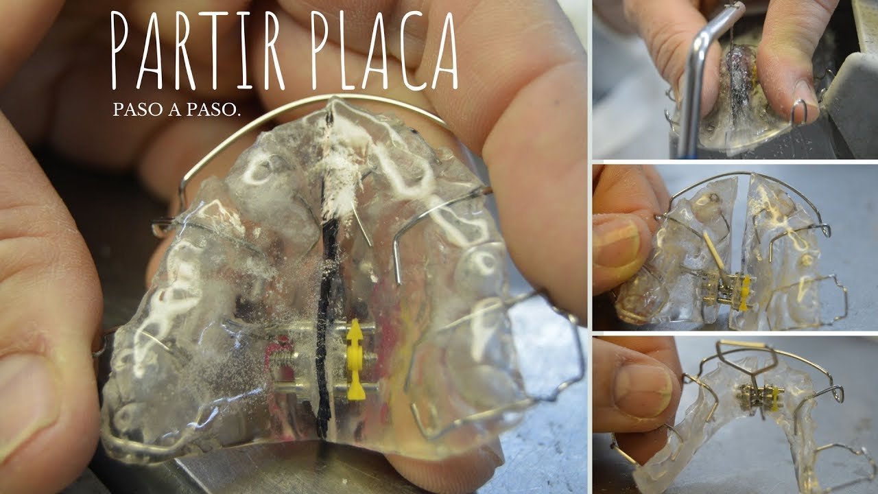Partir placa acrílico con tornillo de expansión • PLACA DE EXPANSIÓN (8/8).