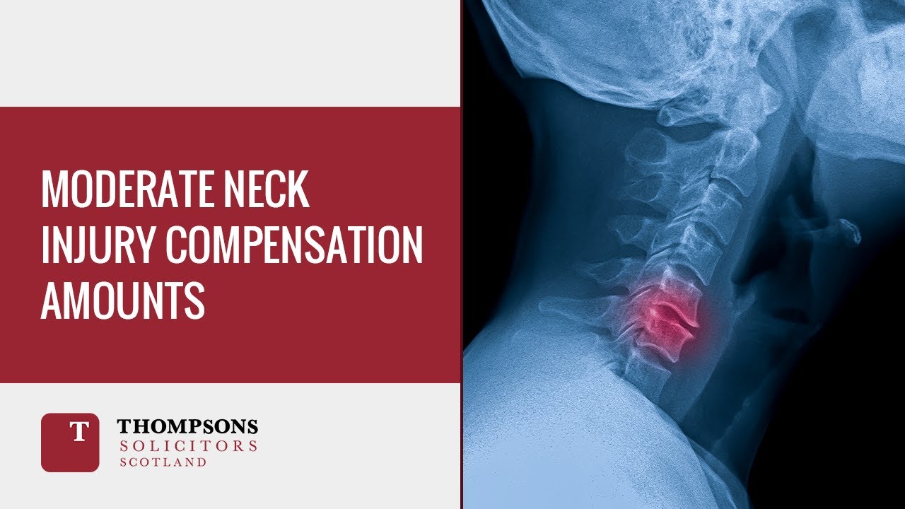 Moderate Neck Injury Compensation Amounts