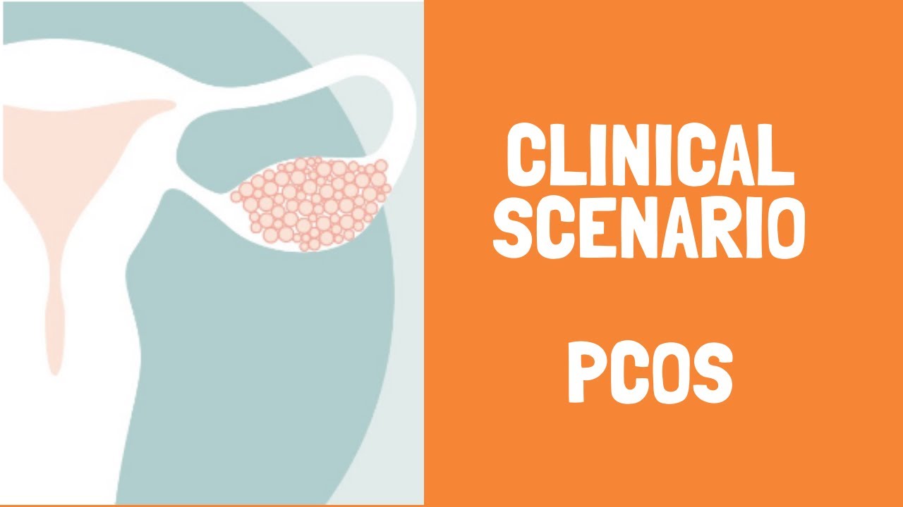 PCOS Clinical scenario- symptoms, diagnosis and treatment by Dr  Shonali Chandra