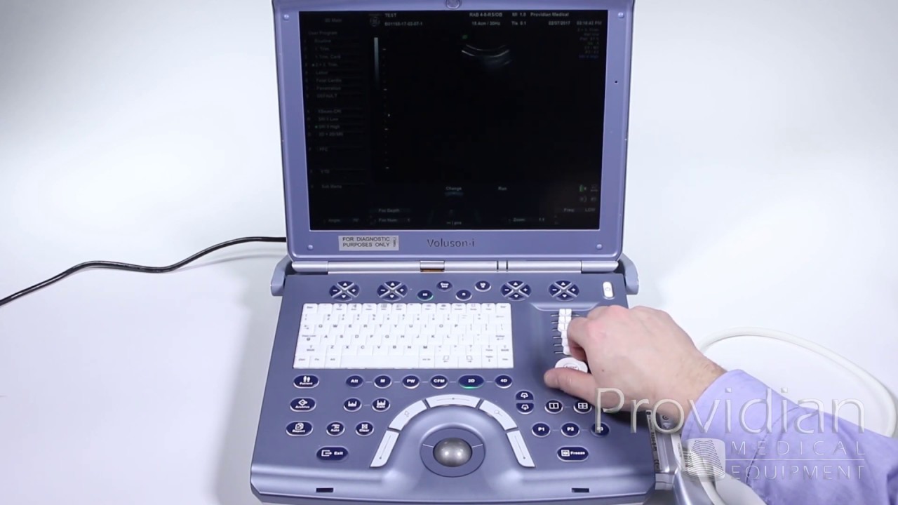 GE Voluson i Training Part 2: 2D Imaging and Image Optimization