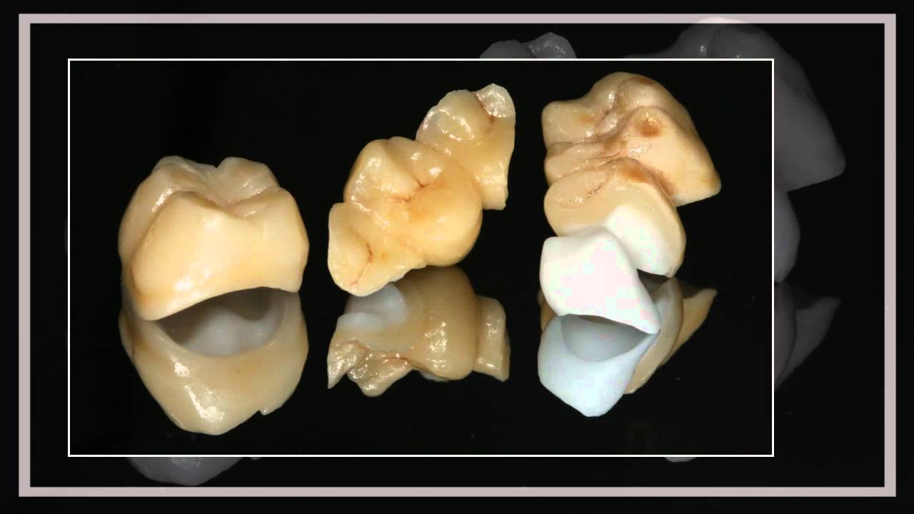 Ducza Labor CAD CAM cirkónium megoldások