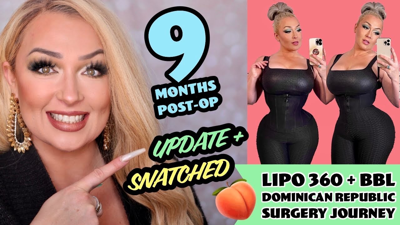 9 Months Post-Op Update + Q&A | Keeping SNATCHED | 360 Lipo + BBL 🍑 Dominican Republic // Dr Medina