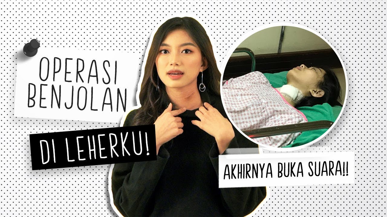 Desy Genoveva Klarifikasi Benjolan di Leher