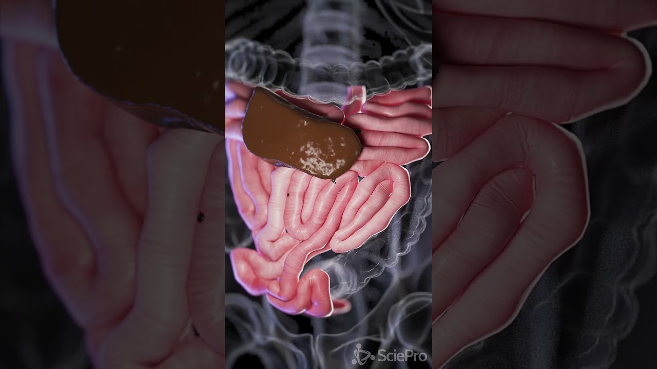 Understanding Small Bowel Perforation  #anatomy #biology #3danimation