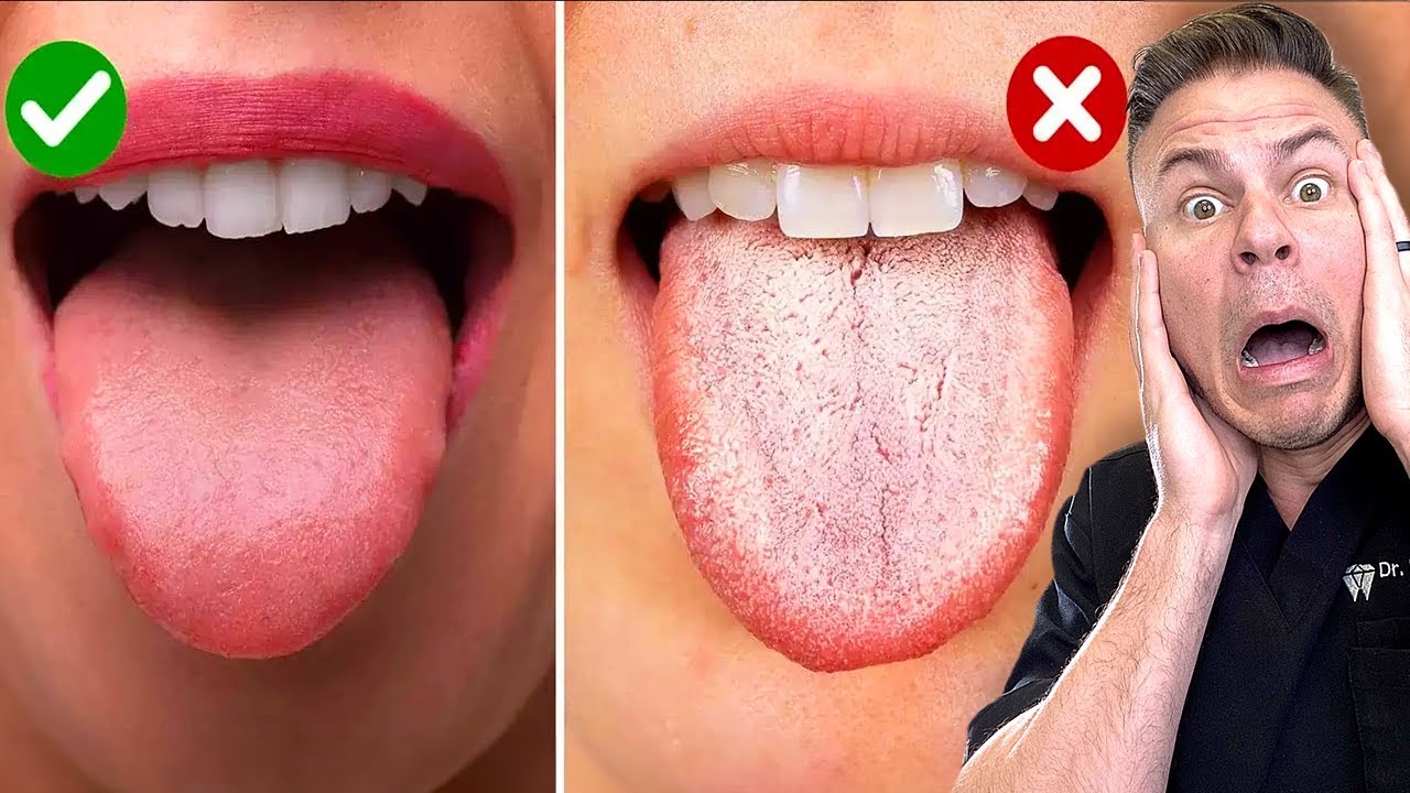 How The Color Of Your Tongue Can Reveal A Dark Truth! 🪥👅