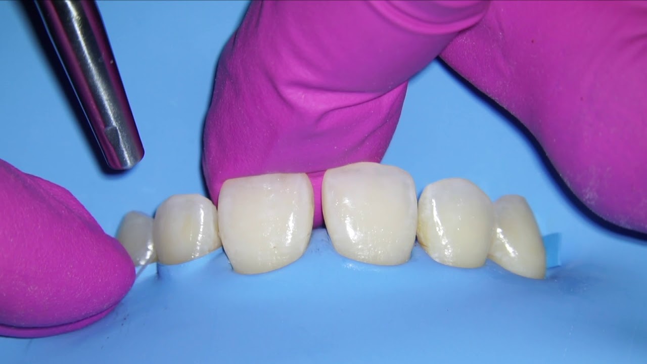 How To Inversion Rubberdam...