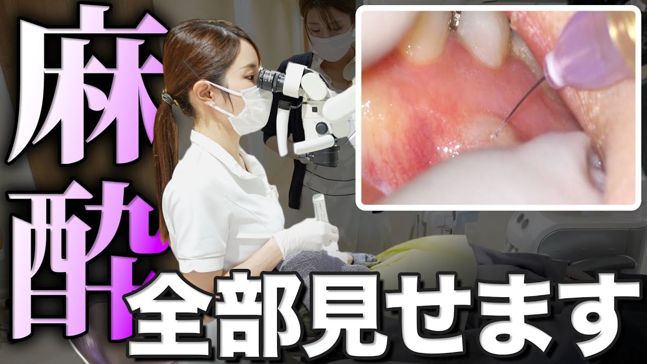 全く痛くないって本当？最高の麻酔注射の一部始終をお見せします。