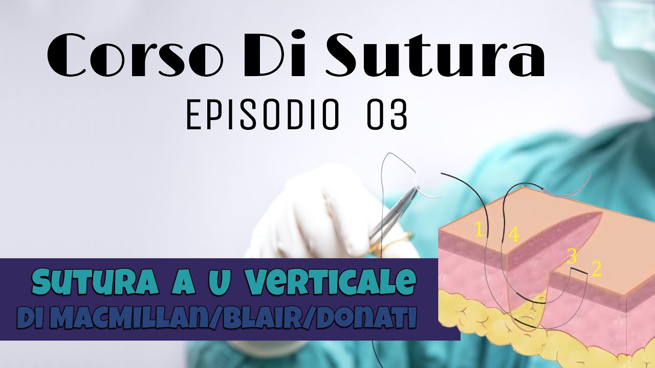 Corso Di Sutura - Episodio 03 - Sutura a U Verticale di Donati, Blair, MacMillan
