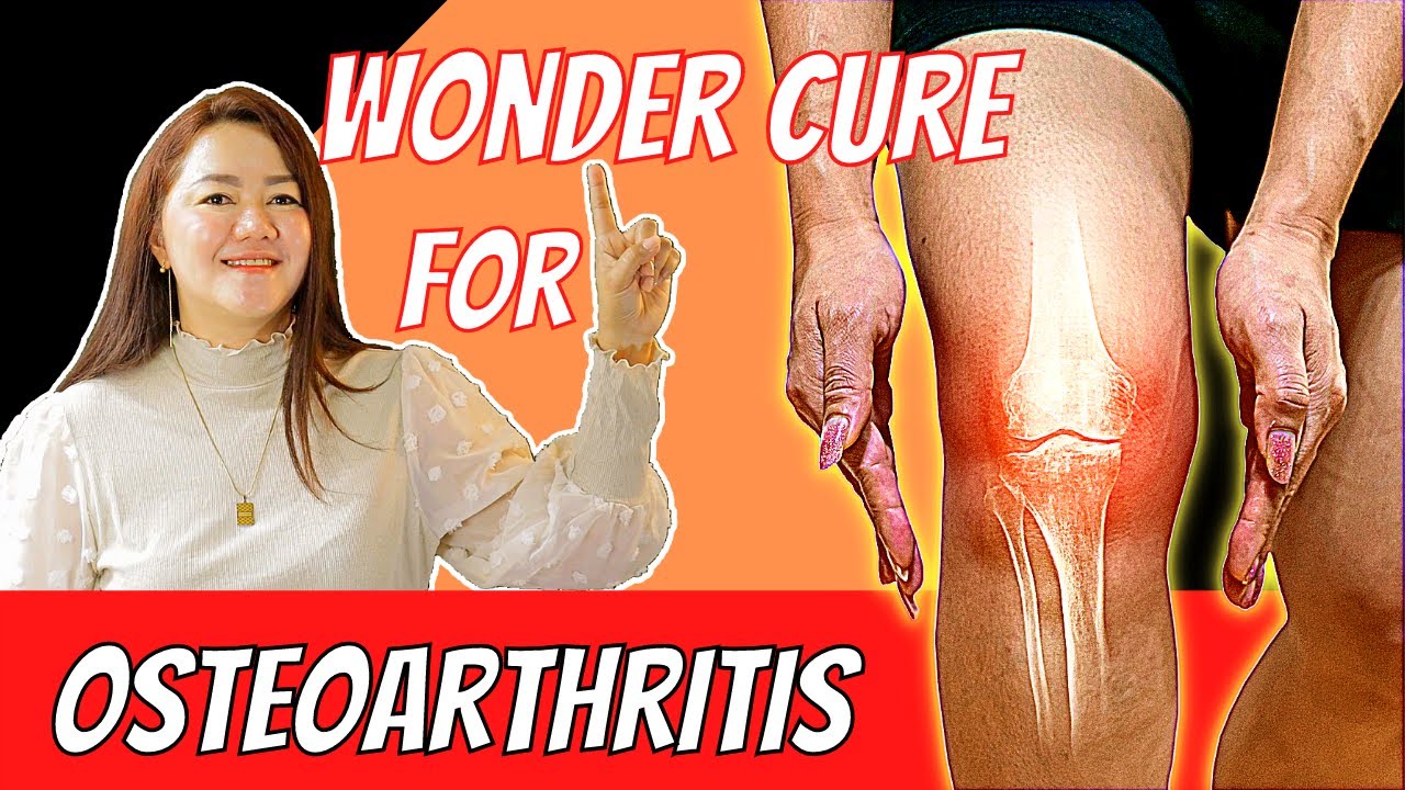 This Can Potentially Repair Cartilage in Osteoarthritis! (UPDATED!) | Doc Cherry