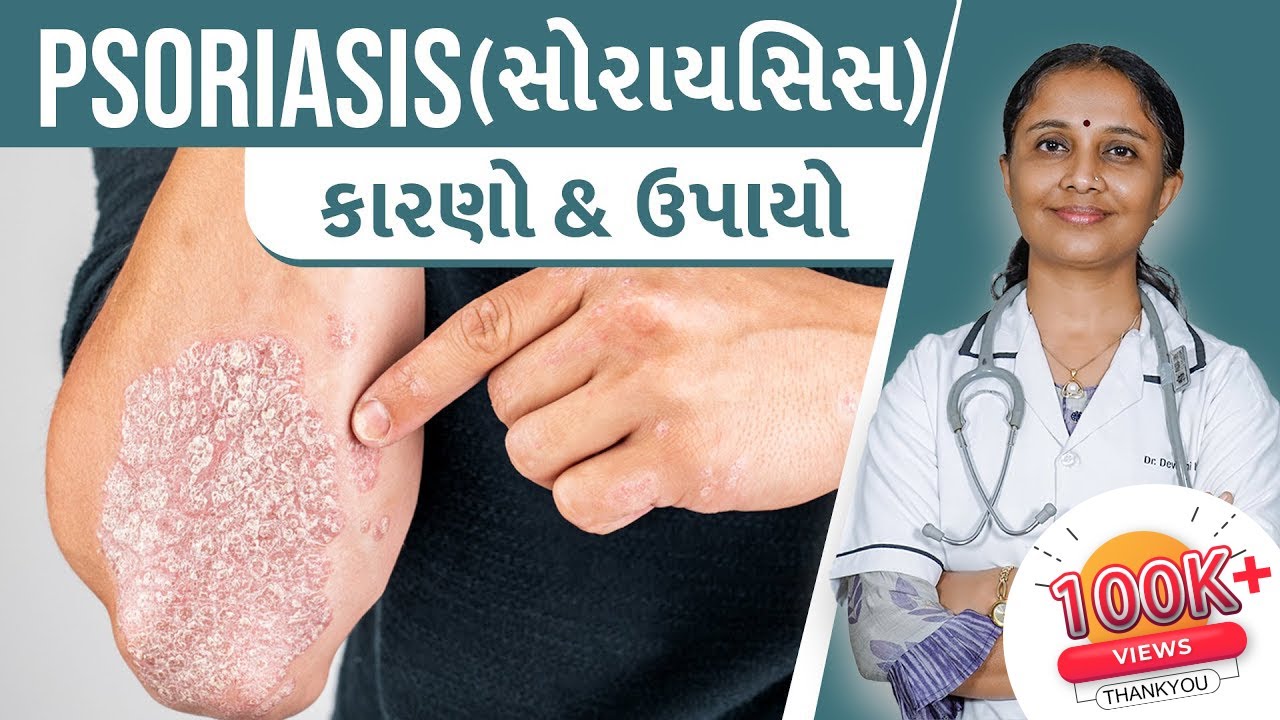 What is Psoriasis? - Types, Symptoms, Causes, and Treatment | Dr. Devangi Jogal l JOGI Ayurved