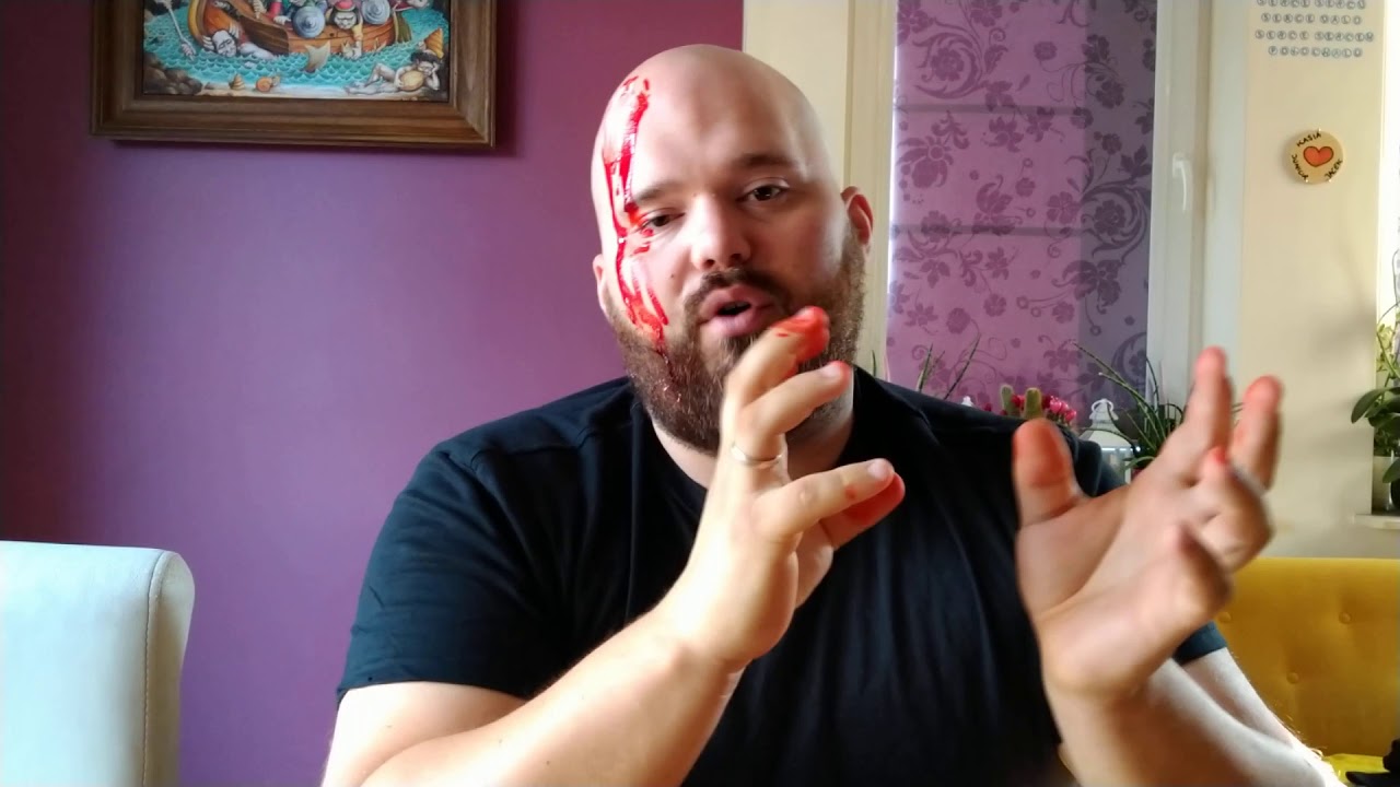 CIAŁO OBCE #11