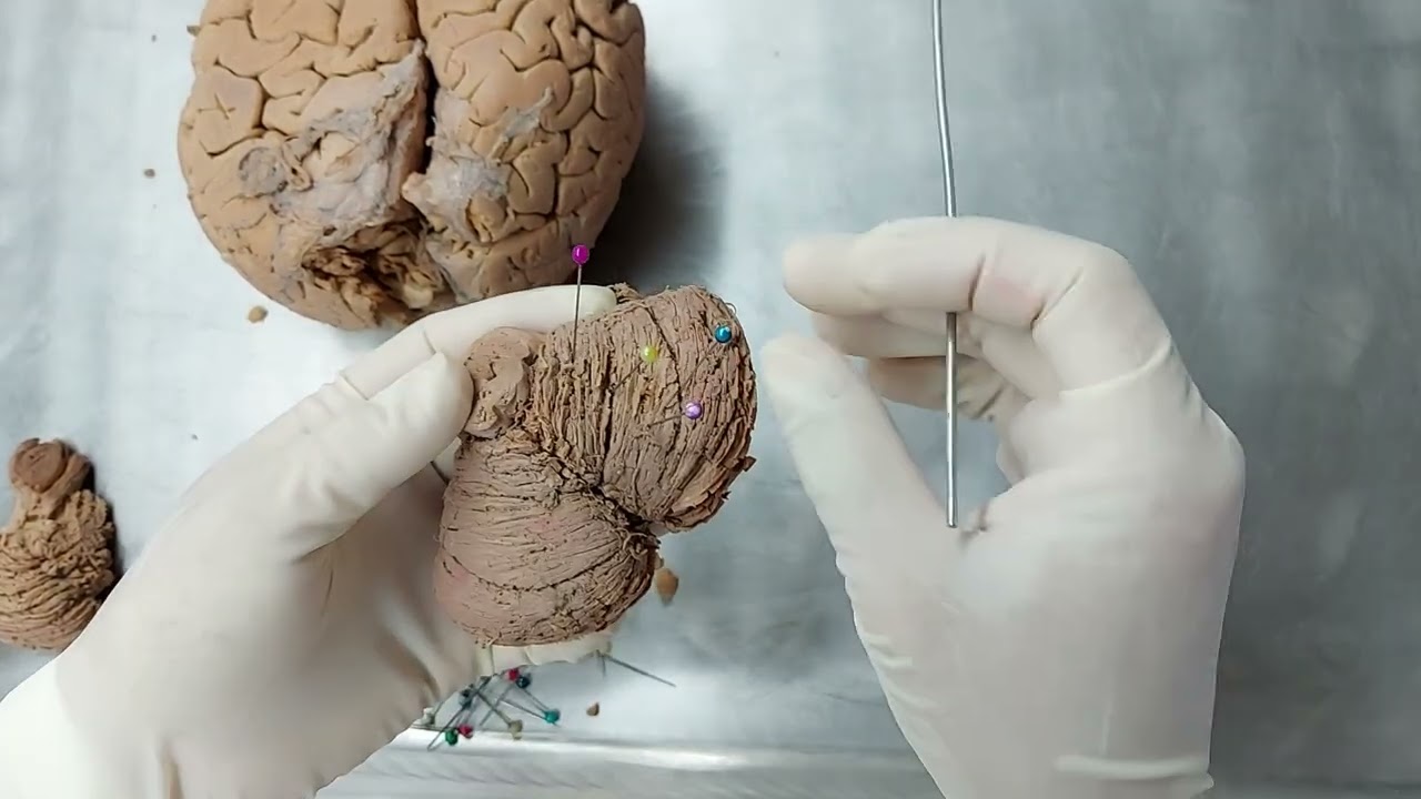 CEREBELO PARTE 1
