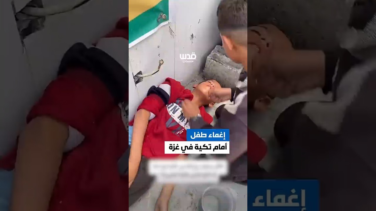 إغماء طفل أثناء التدافع للحصول على الطعام من تكية خيرية في قطاع غزة