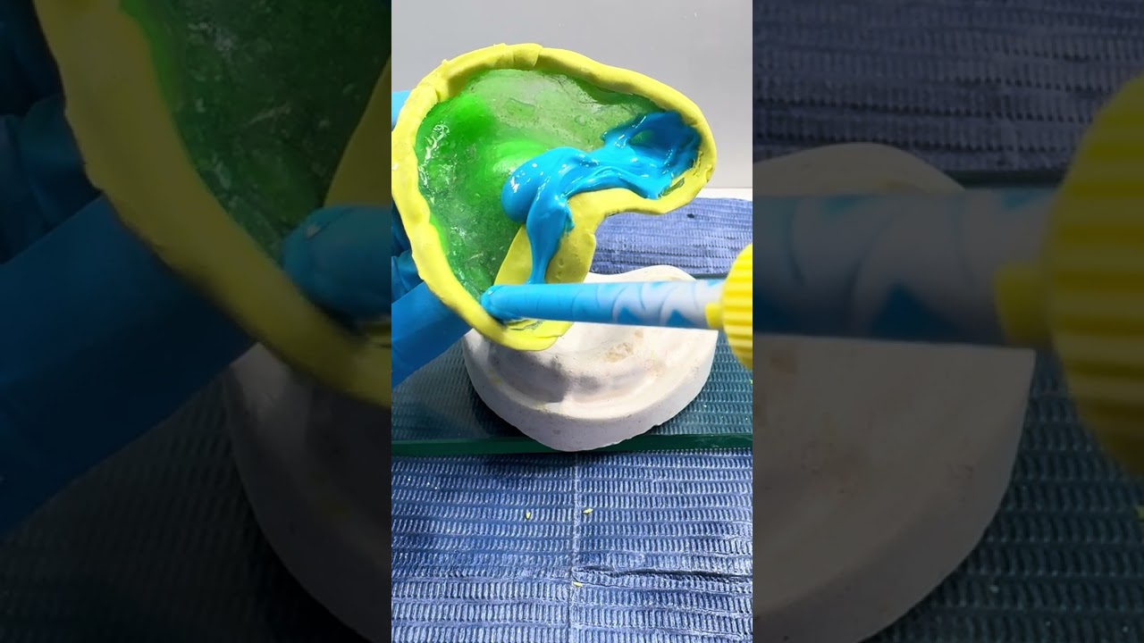 Impresión fisiológica superior en modelo simulado 