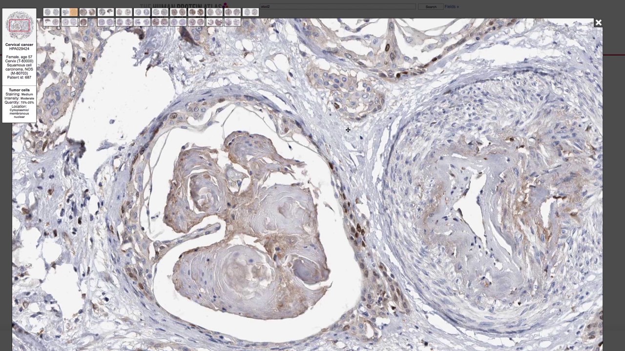 How to explore antibody stainings on the Human Protein Atlas -old