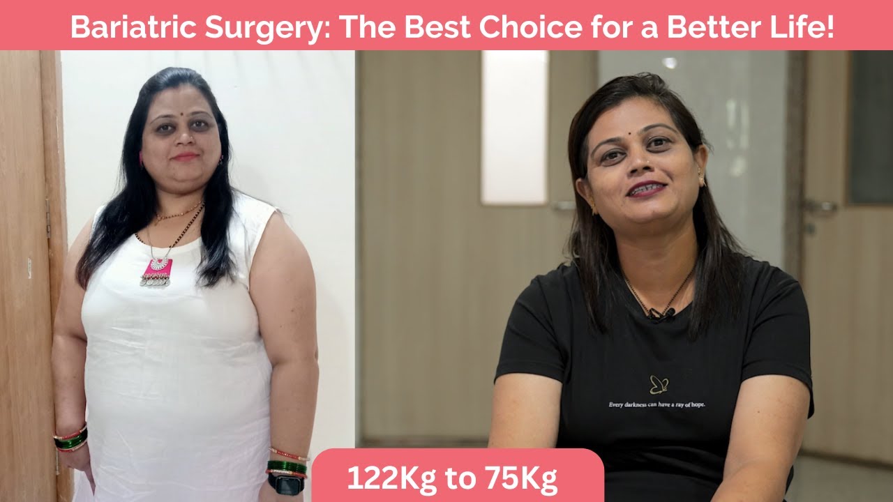 Bariatric Surgery for Weight Loss: An Inspiring Transformation Story