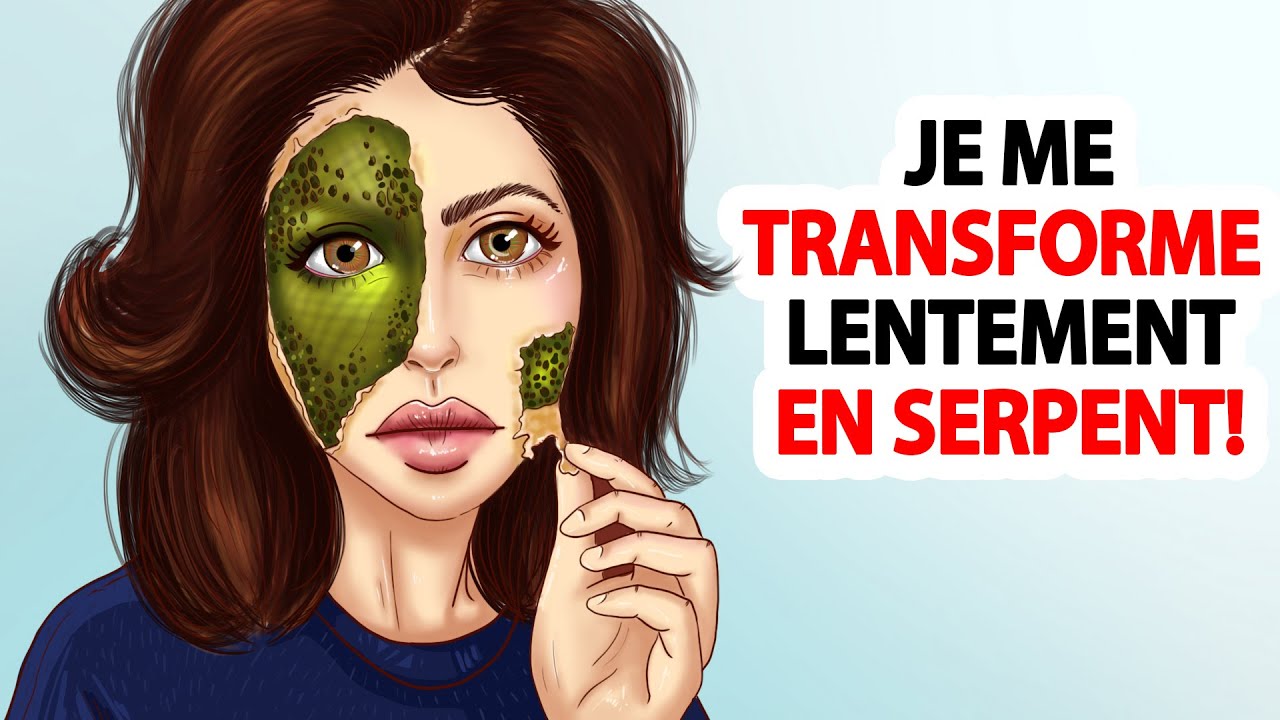 Je Me Transforme Lentement En Serpent!