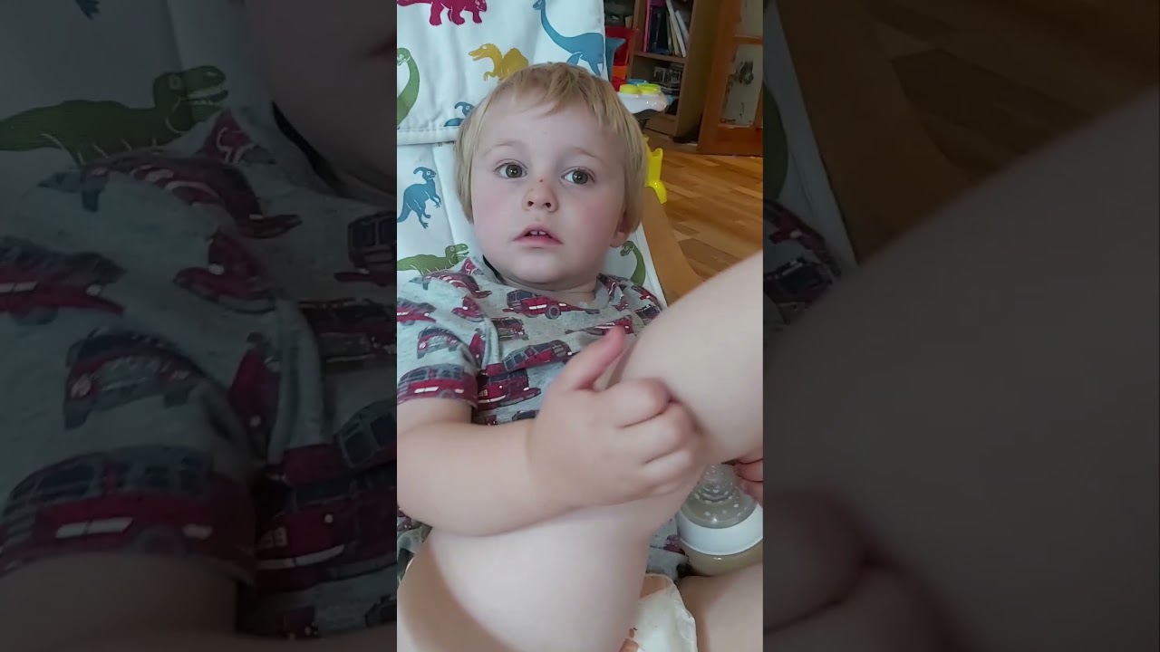 Myoclonic Seizure Confirmed via EEG in Child. Epilepsy Autism. Video For Educational Purposes 2