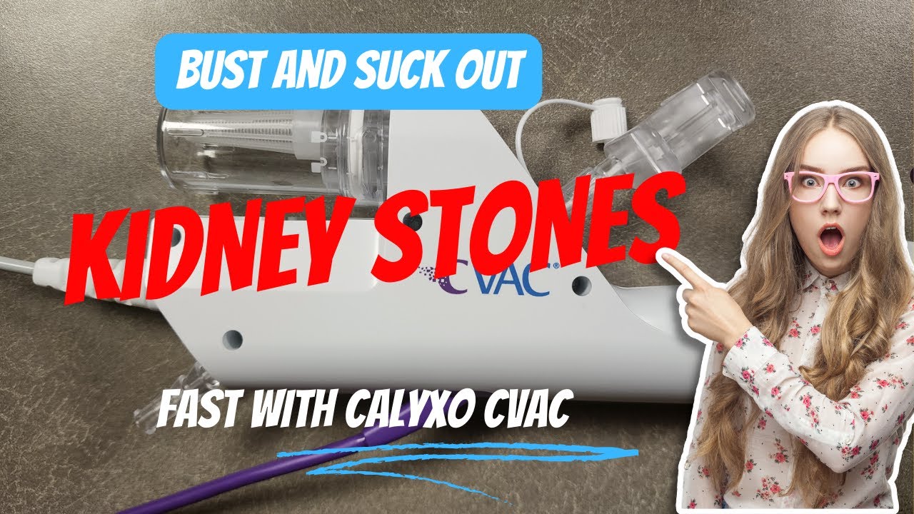 Больше никакой ПНЛ при камнях в почках? Новый CVAC от Calyxo может стать ключом к успеху | AUA 2024