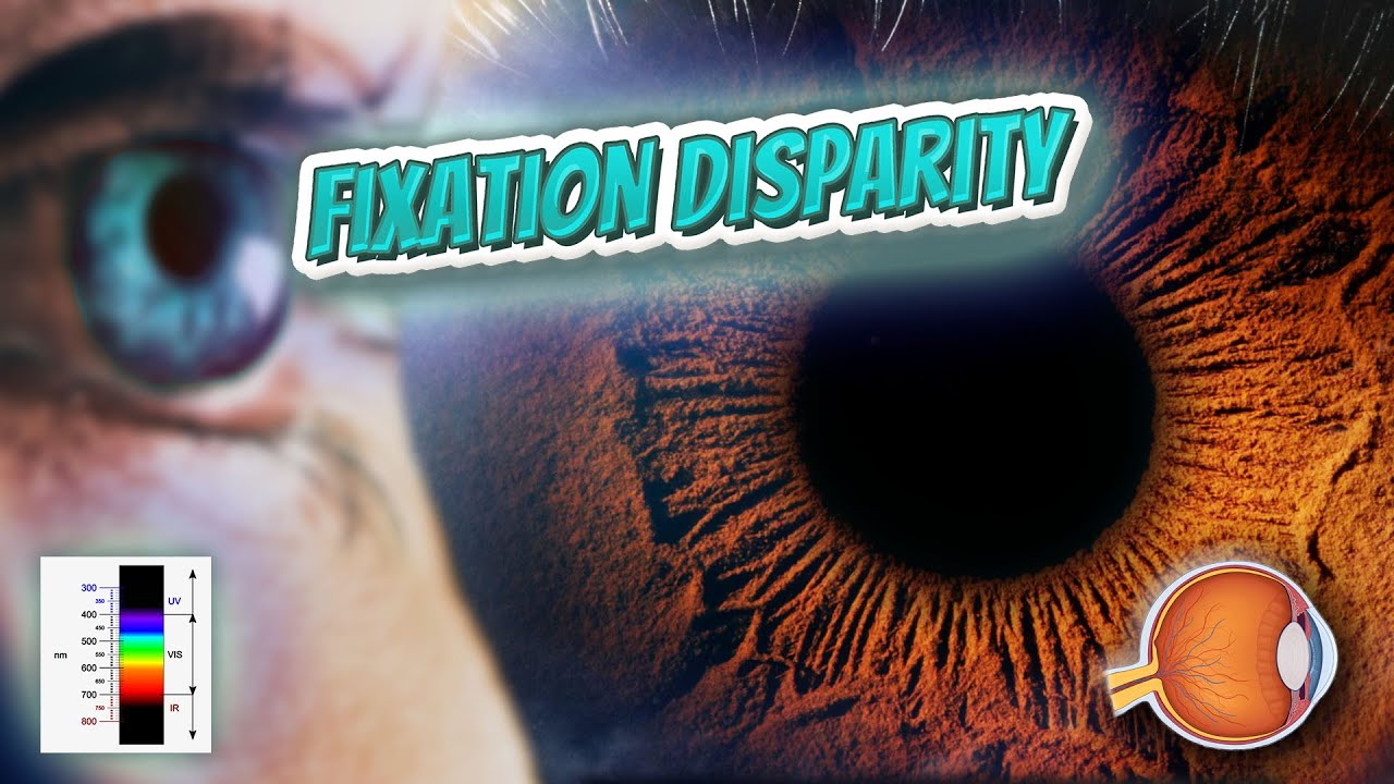 Fixation disparity (Your EYEBALLS) 👁️👁️💉😳💊🔊💯✅