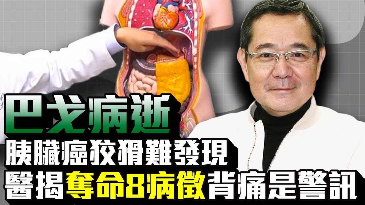 巴戈病逝胰臟癌狡猾難發現　醫揭「奪命8病徵」背痛是警訊｜中時新聞網