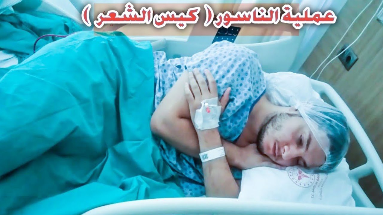 الناسور العصعصي (كيس الشعر) وتجربتي الشخصية مع العملية